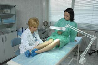 Thérapie au laser pour les varices dans les jambes. 